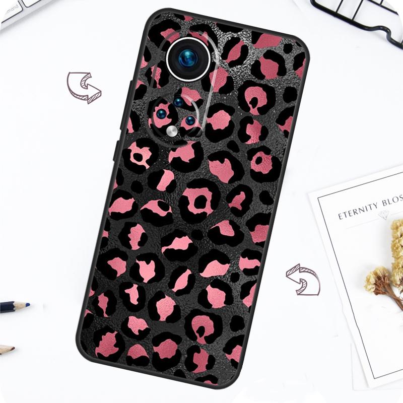 Leopard Print Case For Honor Magic 7 5 6 Lite Honor 200 Pro X8b X9a X8a X8 X9 X9c X9b 50 70 90 Lite Cover