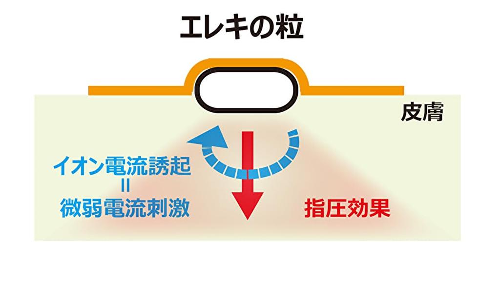 Of 100 Replacement Grains 14 Replacement Stickers 100 A Revolutionary Treatment Device That Uses Acupressure and Weak Current Stimulation To Relieve