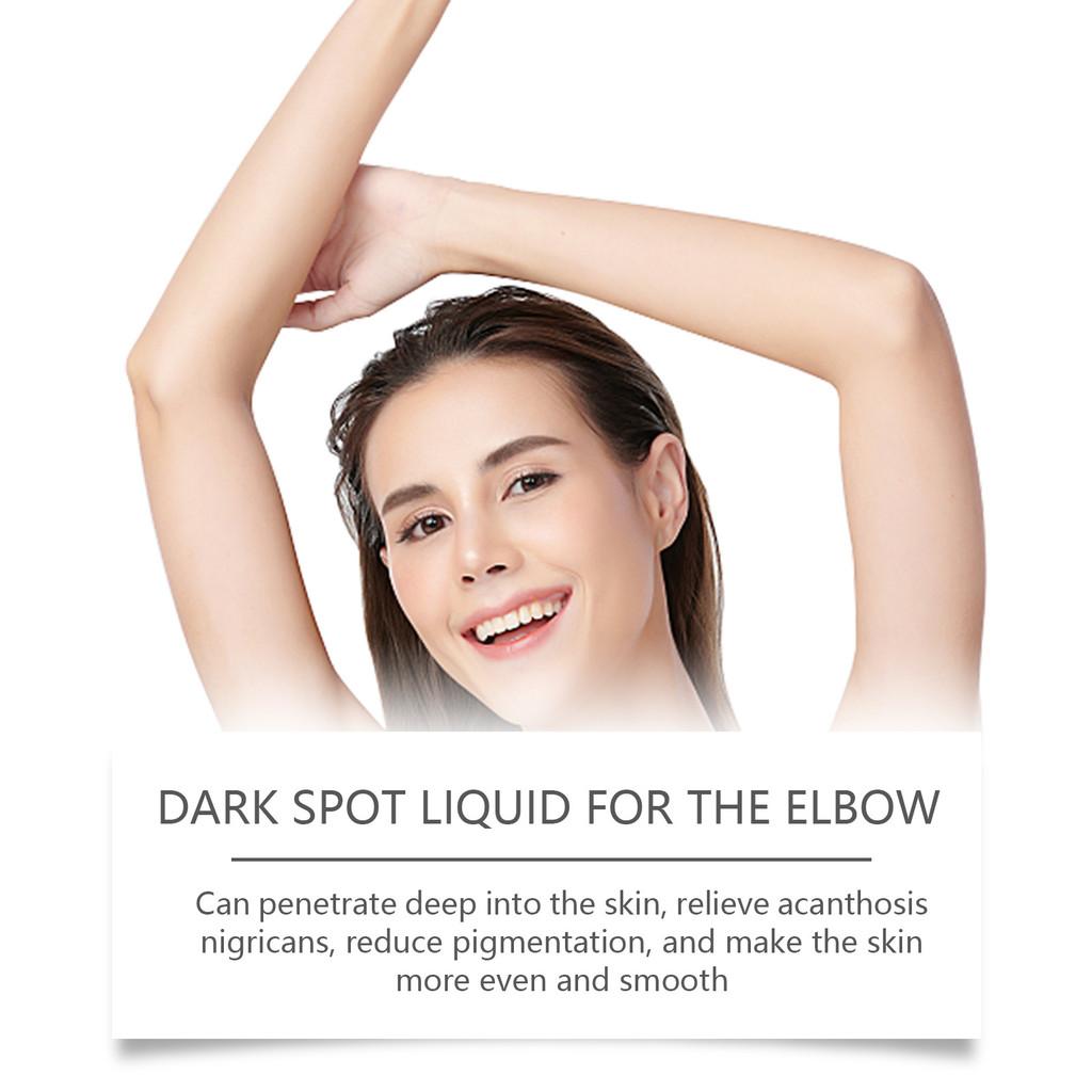 Jaysuing Elbow Skin Care Lotion For Ultimate Moisturizing And Nourishing Relief