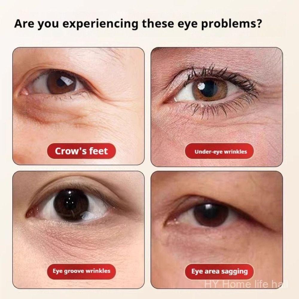 Lotus Pod Eye Massager Roller 5 Teeth Eye Scraping Tendon Stick  for Relieve Facial Fatigue