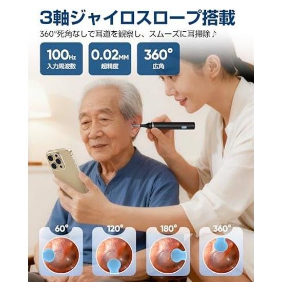 2026 Model 30 Million Pixels Ultra High resolutionAI Temperature Controlear Hook Tweezers Included Ear Cleaner Camera Cleaning Pick 360 Earwax Removal