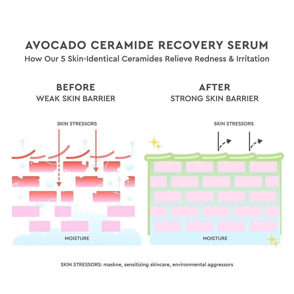 Glhrezept Avocado Ceramid Serum - Feuchtigkeitsgesichtserum fr Frauen & Mnner - Rtung Rtung Trockener Haut- und Hautbarriere Reparatur - Lei