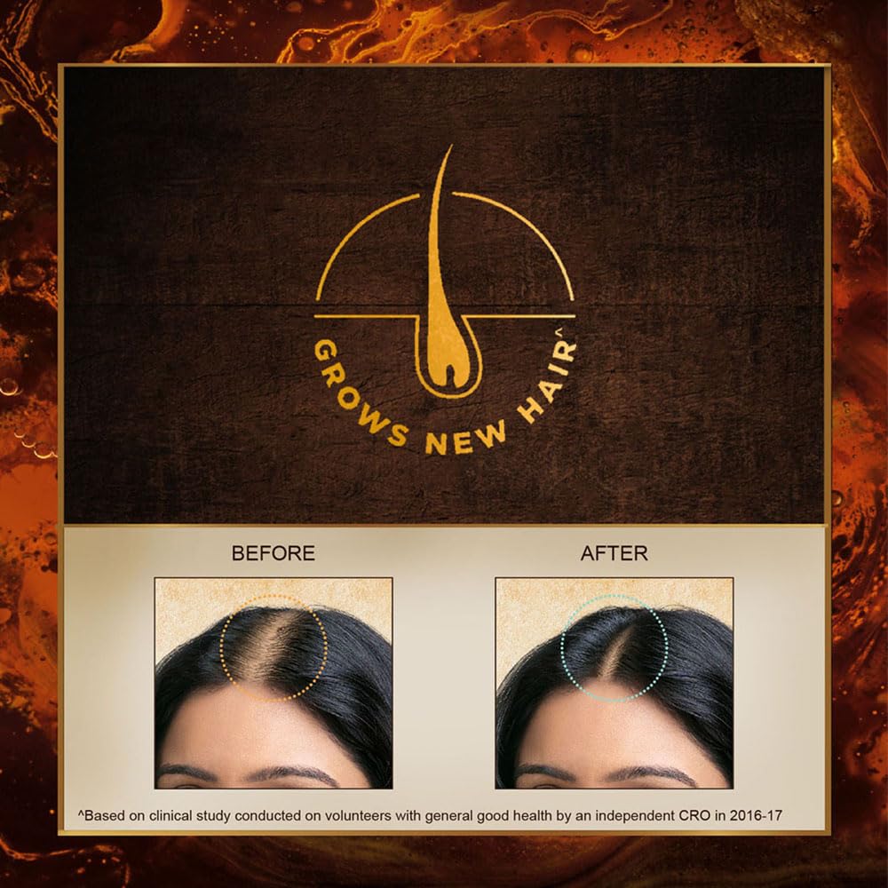 Indulekha Bringha Ayurvedic Hair Oil 100ml Pack for Hair Fall Control with Amla Coconut Oil Comb Applicator