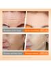 5Pcs Set Vitamin Cheek Forehead Filler Set Fill And Lighten Fine Lines In Skin Firms The Skin Improv