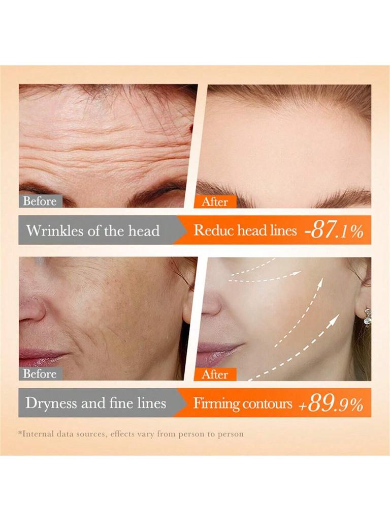 5Pcs Set Vitamin Cheek Forehead Filler Set Fill And Lighten Fine Lines In Skin Firms The Skin Improv
