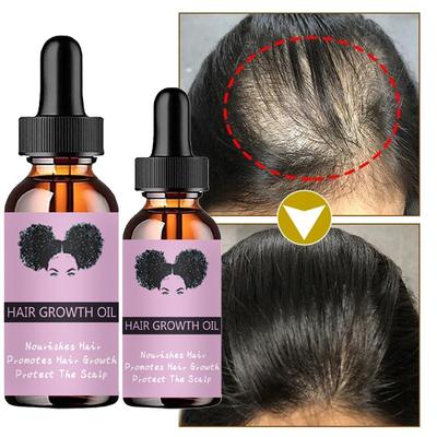 7DAYS Ginger Hair Growth Nutrient Solution Hair Loss Treatment Essential Oil Hair Care Essential Oil Men's Hair Conditioner