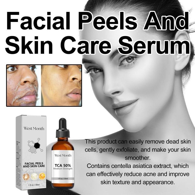 West Month Anti-acne Repair Serum For Diminishing Dark Spots And Cleansing Skin Imperfections