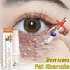 Eye Fat Granules Removal Eye Stick Anti-Puffiness Firming Cream Anti Inflammatory Fade Fine Line Repair Skin Barrier Skin Care