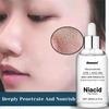 Niacinamide Face Serum for Acne Control & Oil Balancing with Zinc - Face Serum, for Face, Even Skin Tone, Korean Skin, 60ML