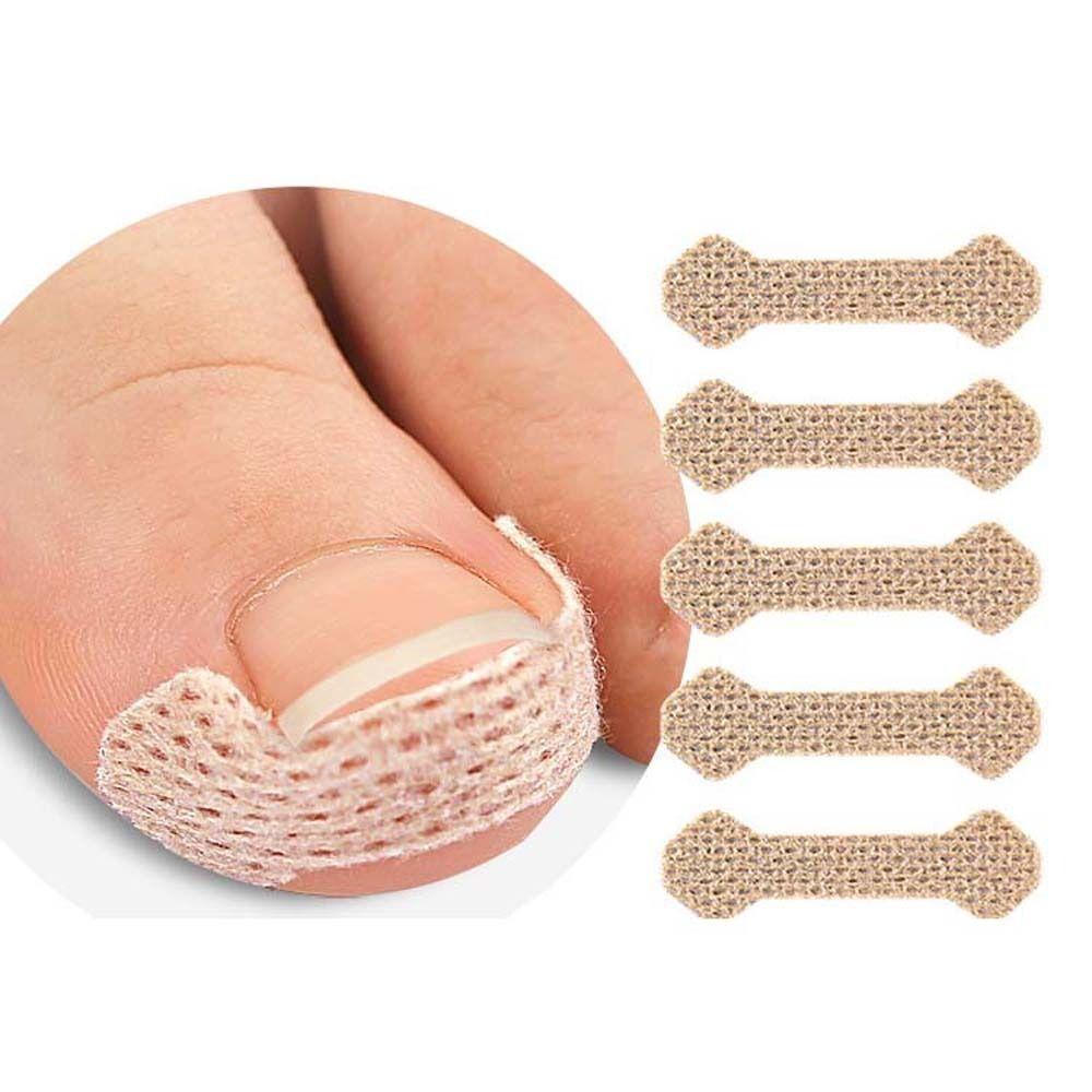 10 adet/takım Ayak Tırnağı Düzeltme Aracı Tırnak Tedavisi Elastik Yama Brace Pedikür Aracı Tırnak Düzeltme Çıkartmalar