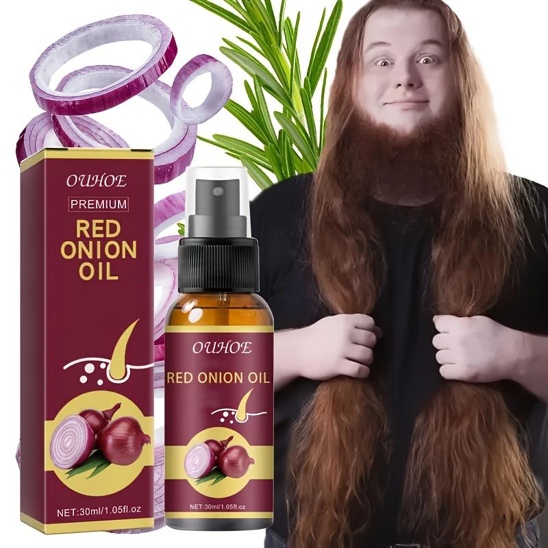 Spray Sérum Puissant pour la Croissance des Cheveux Repousse Cheveux Traitement Anti-Chute Essence Réparatrice Cheveux Nourrit la Racine pour Hommes Femmes Soin Capillaire