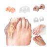 1 pár silikonový korektor hallux valgus pro pedikúru, chránič kuřího oka, narovnávač, gelový oddělovač prstů na nohou, nástroj pro péči o nohy