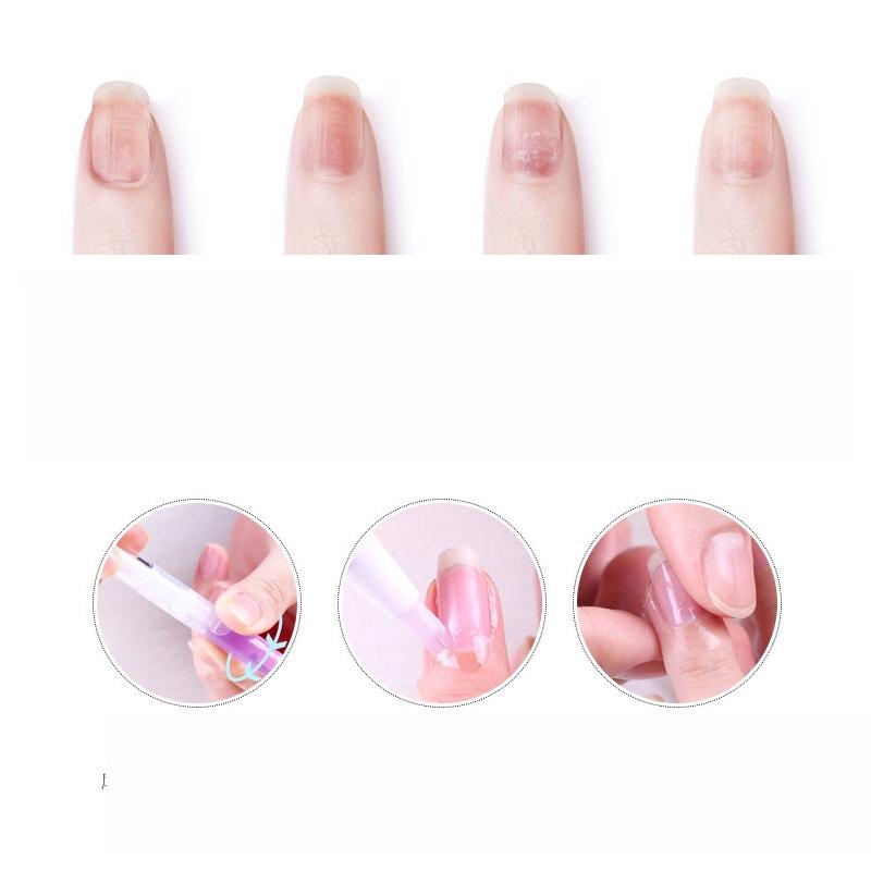 Plant Fruit Essence Nail Tool Nail Repair Nutrition Pen Nail Nourishing Liquid Anti-barb Anti-dead Skin Moisturizing Maintenance Edge Oil Care Pen