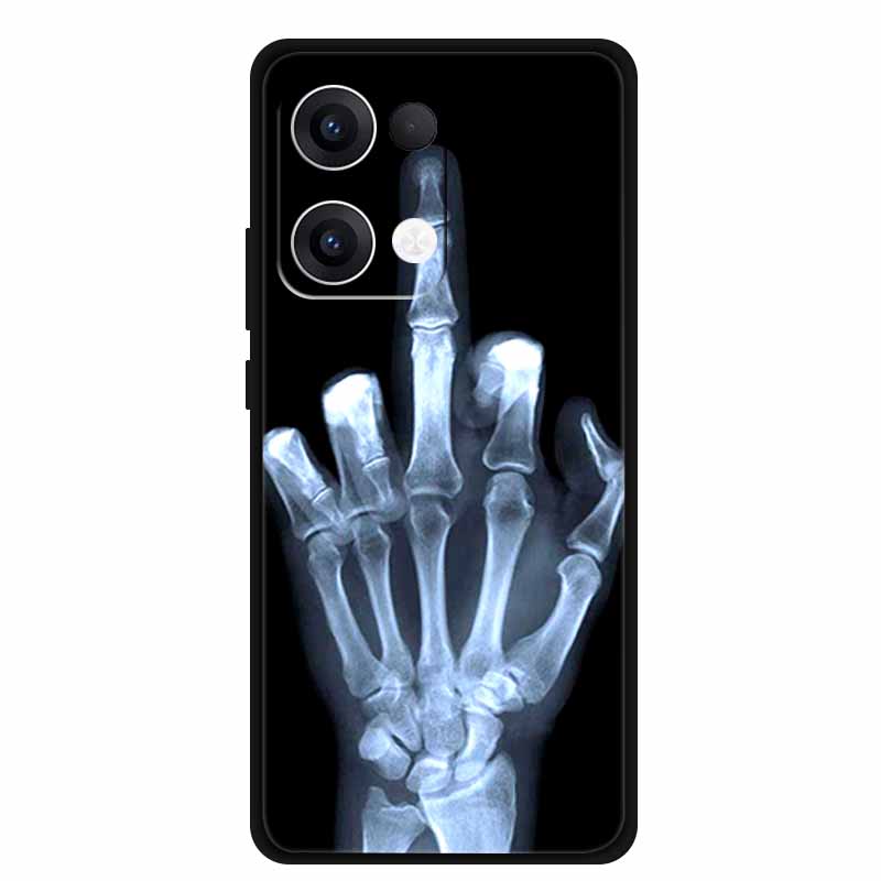For Oppo Reno13 5G Case Reno13 Pro 5G Soft TPU Silicone Cover for Reno 13/ Reno13 Pro Soft Case Protective Phone Cases Reno13 5G