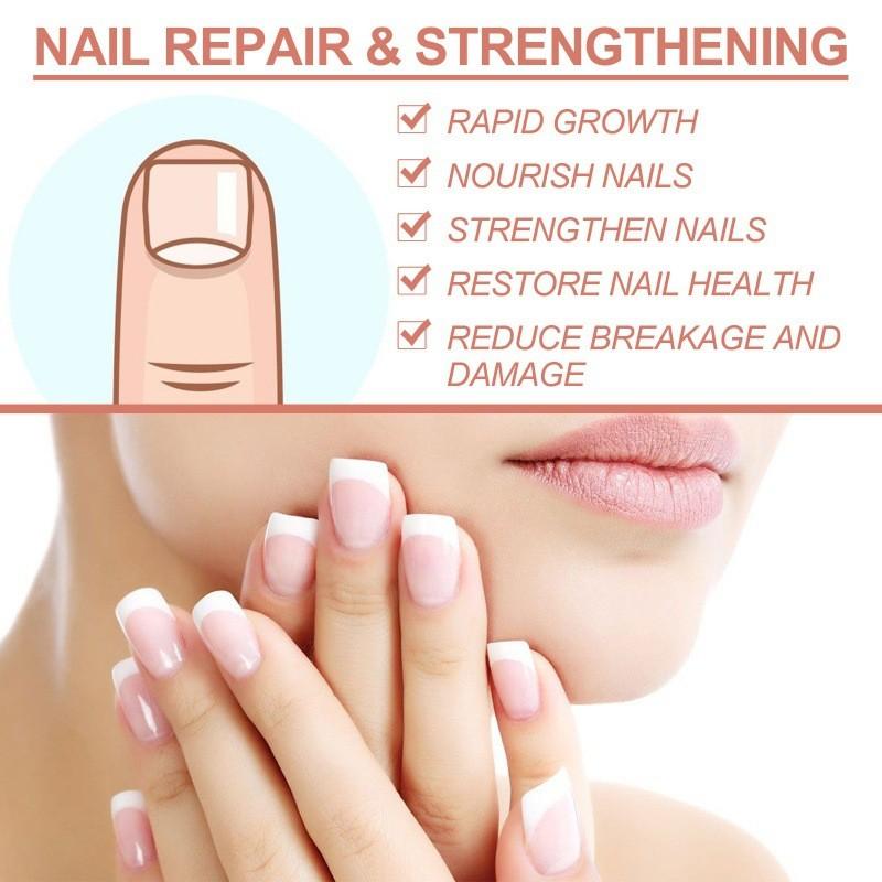 Revitalizing Ouhoe 7 Day Nail Repair Essence For Healthy Strong Nails And Toenails