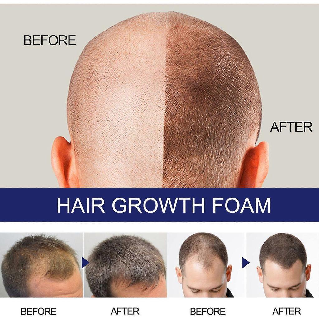 Men's thick hair foam men's hair thick moisturizing care deep repair hair root