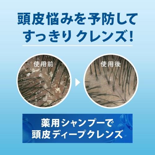 h&s moisture intensive treatment  2 h&s