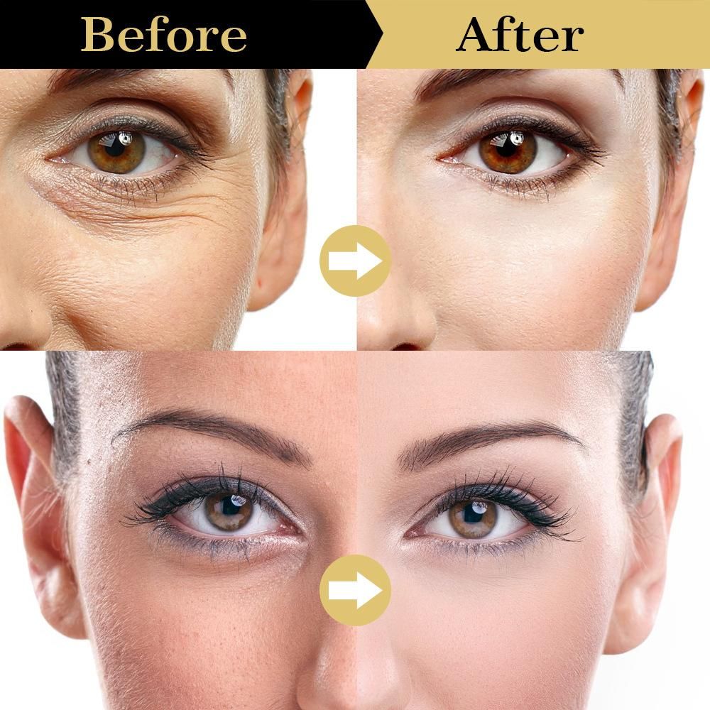 Whitening Moisturizer, Brightens Skin Tone, Moisturizes, Lightens Dullness, Tightens Skin