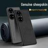 Shiyong Huawei Leather Texture Phone Case