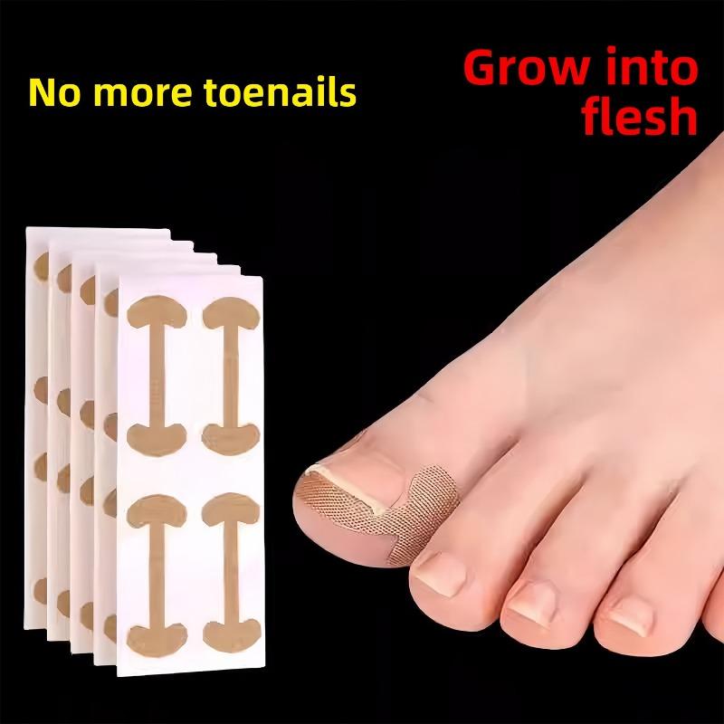 The Nail Improvement Tool for The Nail Groove - Isolates The Toenail, Allows for The Growth of The Nail, and Fills In The Area with A Padding Pad.