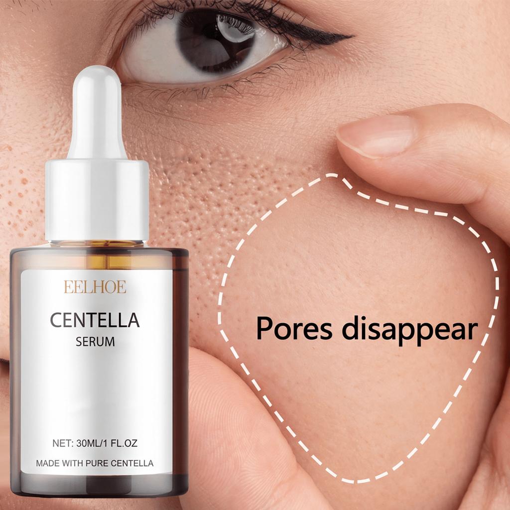 1pc Snowflake Grass Essence, 30ml Facial Serum, Highly Moisturizing, Gentle Repair, Pore Refining, A