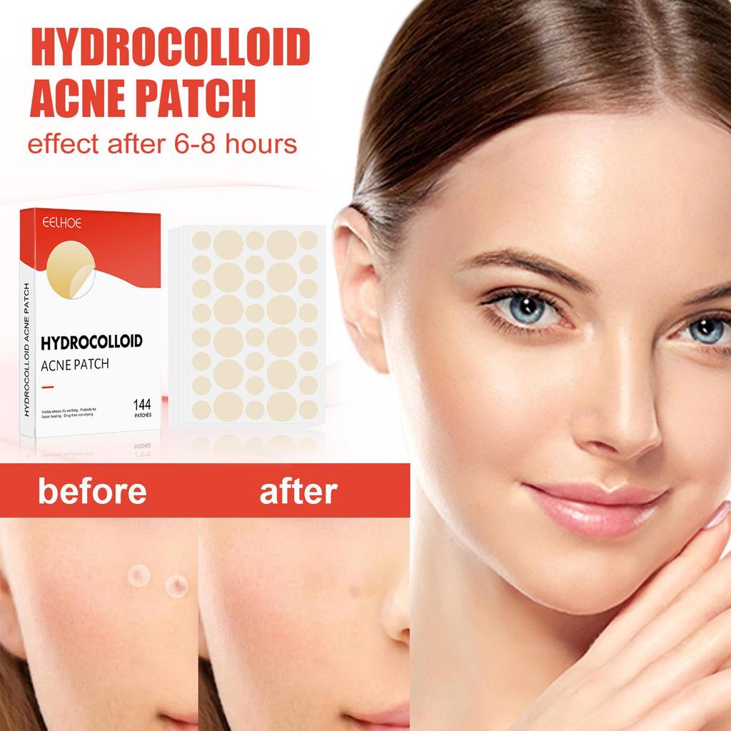 EELHOE Invisible Hydrocolloid Pimple Patch for Acne and Blemish Removal - Waterproof & Breathable Facial Care