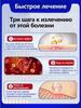 Chinese MIRACLE Ointment for middle and elderly people, 100% natural, not hormonal, hemorrhoid cream Zhi Chuan Gao 15 g