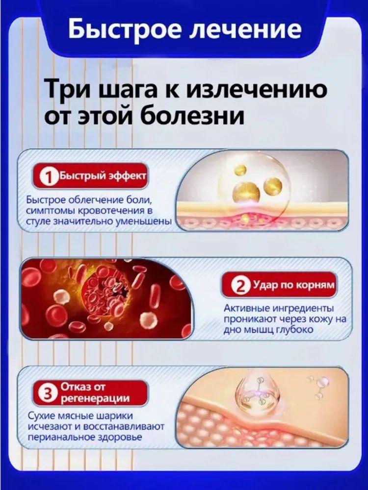Chinese MIRACLE Ointment for middle and elderly people, 100% natural, not hormonal, hemorrhoid cream Zhi Chuan Gao 15 g