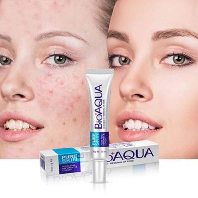 Bioaqua 30g Acne Treatment Blackhead Remova Anti Acne Cream Oil Control Shrink Pores Acne Scar Remove Face Care Whitening