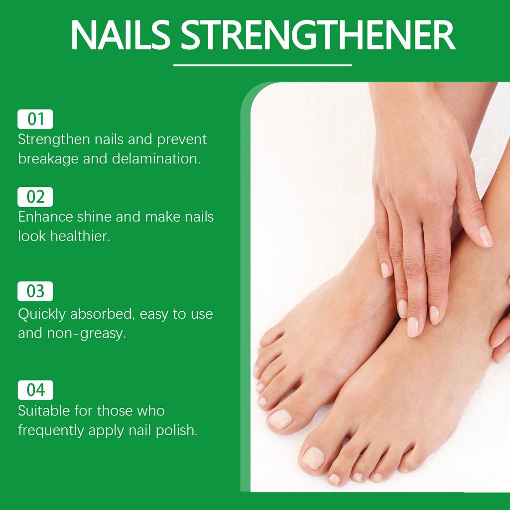 Eelhope Nagelreparaturflüssigkeit Nährende Formel Zum Erweichen Raue Nagelhaut Und Zur Verbesserung Des Glanzes 15ml