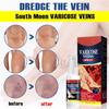 Vein Varicose Veins Spray, Vein Varicose Veins Spray, Vein Varicose Veins Spray 30ml