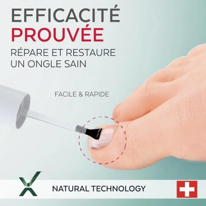 PODERM - Sérum Ongles Rongés - Répare, Fortifie & Embellit - Formule 100% Naturelle & Vegan - Swiss Made - Flacon 8ml