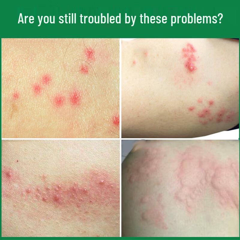 Seven Herbs Portable Anti-Itch Balm 20g