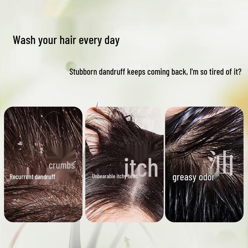 Bawang Anti-Dandruff & Oil Control Shampoo