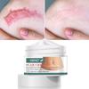 Deeply Permeate Cuticle Skin Care Acne Stretch Scar Cream
