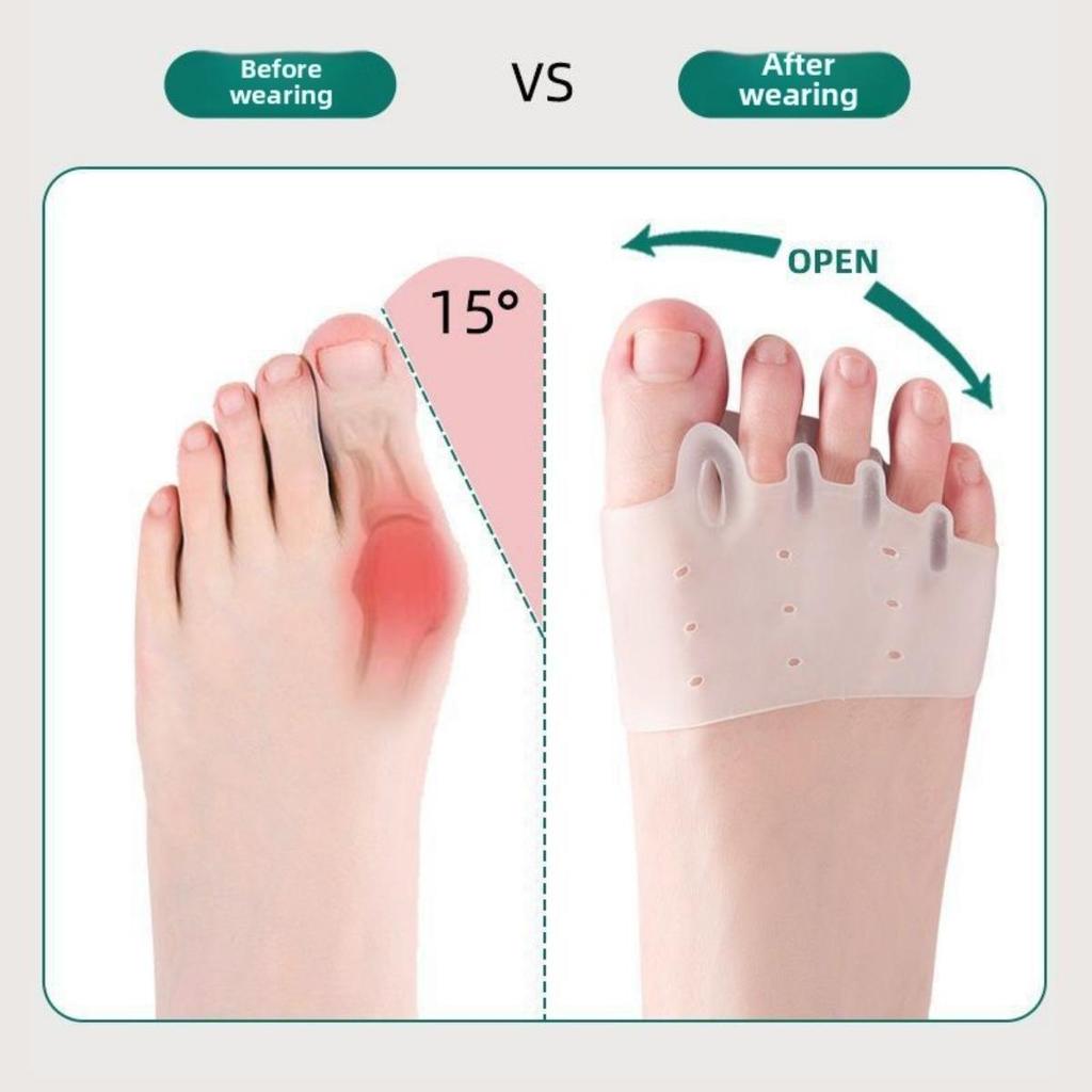 2 stuks Teenspreider Gemaakt van Silicagel met Hallux Valgus Brace-Comfortabel Voetuitlijningshulpmiddel Om het Effect van Fittnesstraining te Verbeteren