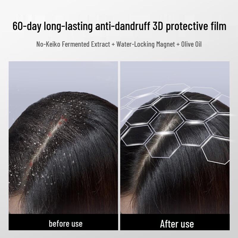 ZIYUAN Blue Aurora Anti-Dandruff Oil Control Shampoo 215g