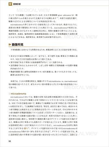 Pituitary gland imaging