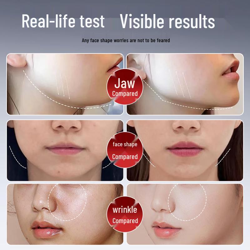 Ou Quanlin Facial Lifting & Slimming V-Face Device