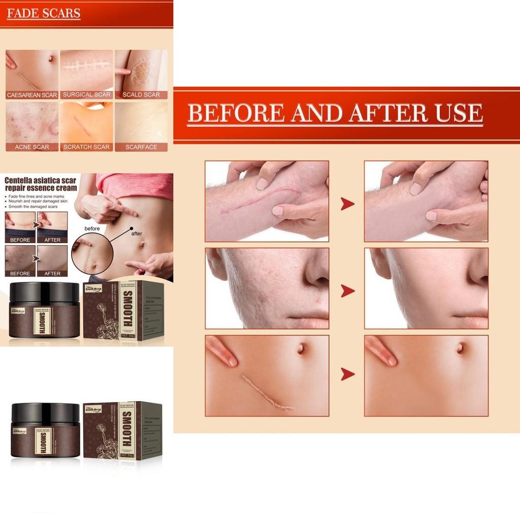 South Moon Centella Scar Repair Cream Moisturizing Skin Tightening And Smoothing Formula For Scars And Blemishes