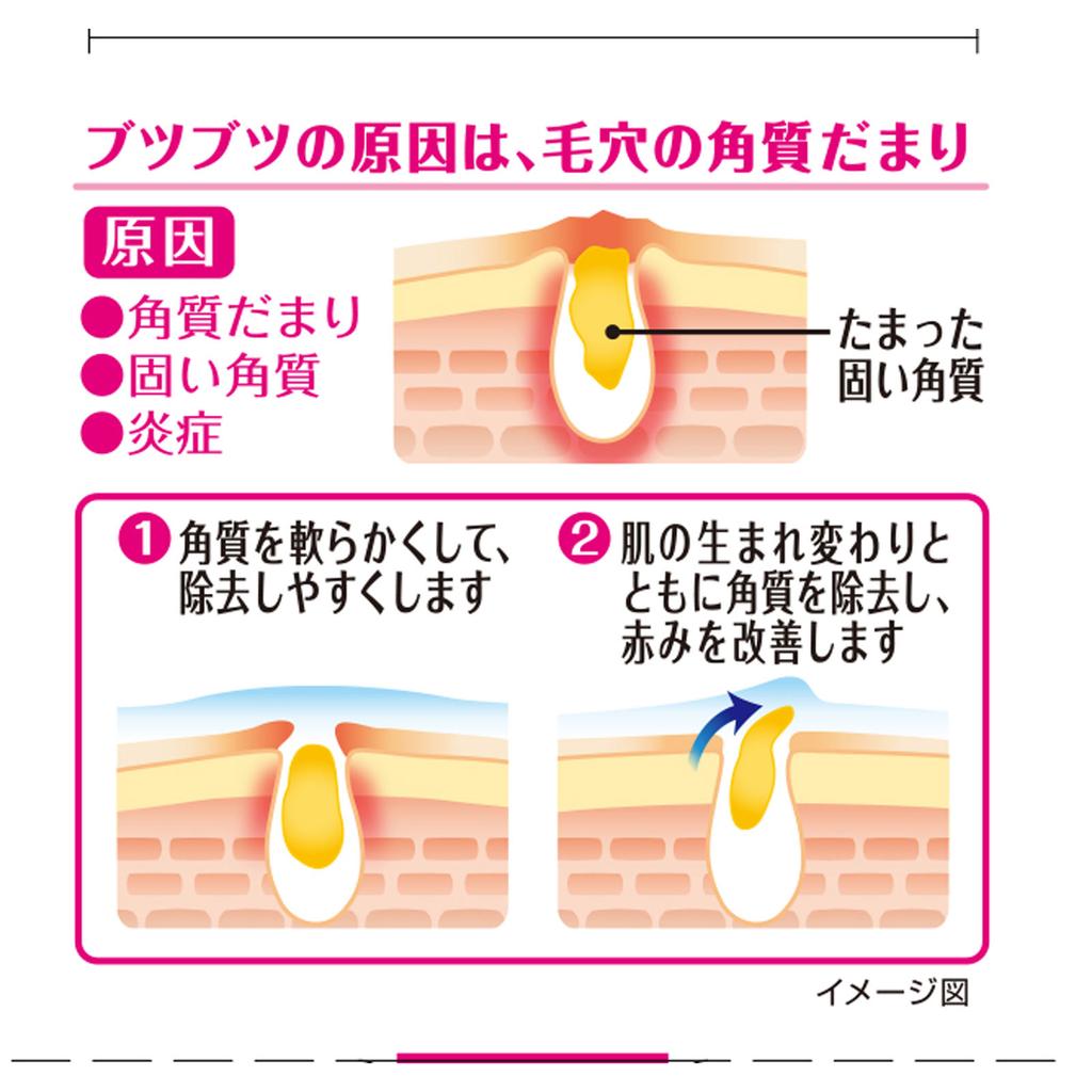 KOBAYASHI Pharmaceutical Ninocure 30g Other (check Locks, Tongue Cleaners, Etc.) Indications: Rough Skin, Keratosis On Elbows, Knees, Heels, Ankles, C