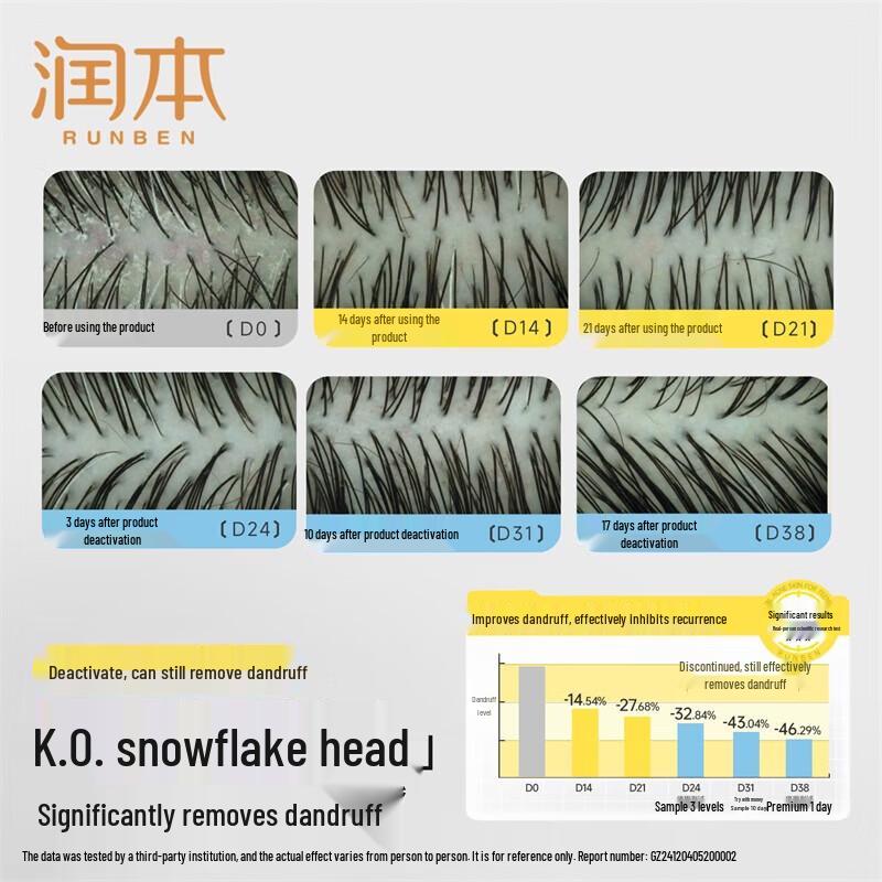 RUNBEN Teenager Anti-Dandruff & Oil Control Volumizing Shampoo