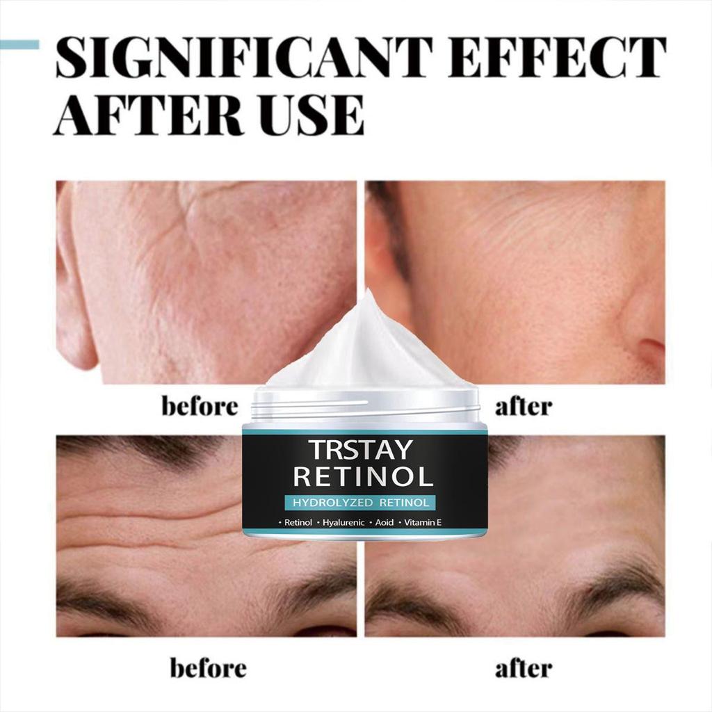 Pánský krém na obličej TRSTAY zpevňuje oční pokožku, vyhlazuje jemné linky kolem očí, redukuje oční váčky a odstraňuje tmavé kruhy