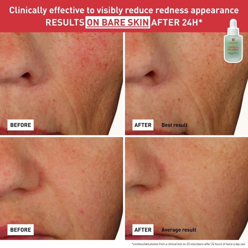 Erborian Centella Red Serum For Visible Redness 30 Ml