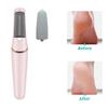 Electric Foot File Callus Remover Dead Skin Removal Pedicure Tools for Hard Cracked Dry Skin Pedicure Feet Care Heel Cleaning