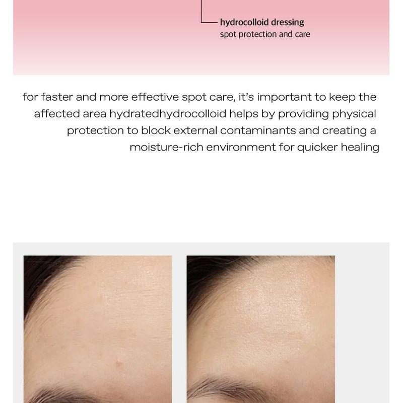 glow Diamond Drop Blemish Patch