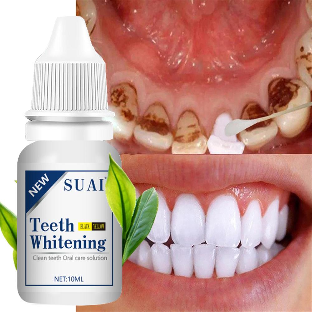 Teeth Brightening Tooth Cleaning Liquid to Remove Tooth Stains, Smoke Stains, Tartar, Oral Cleaning