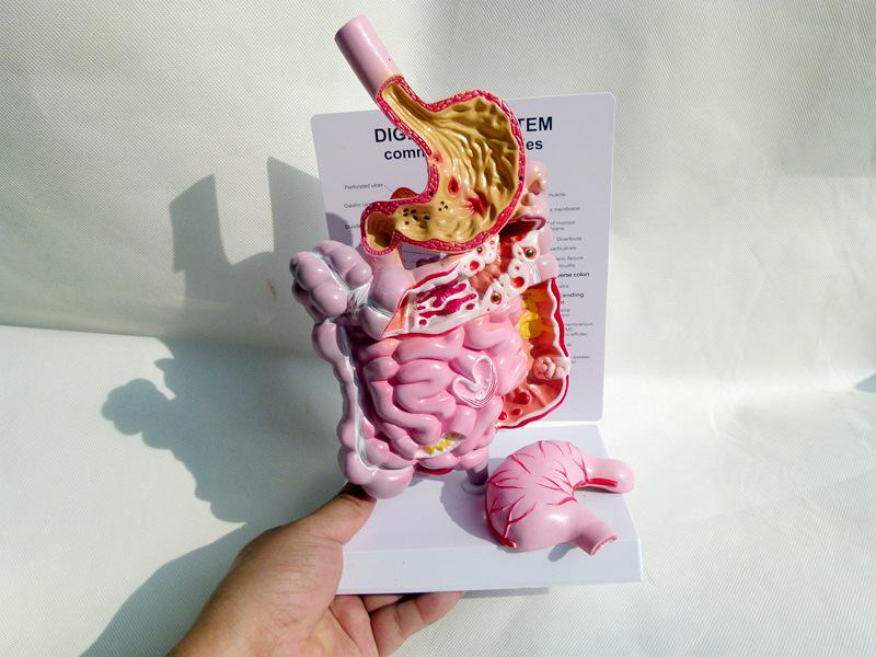 Human Digestive System Model: Large Intestine, Rectum, Duodenum, Stomach & Intestines Anatomical Structure