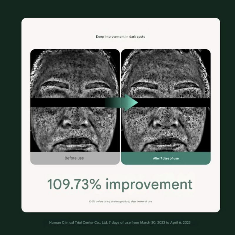 MOMMY CARE Perilla Seed Brightening Cream Extra Large 80g