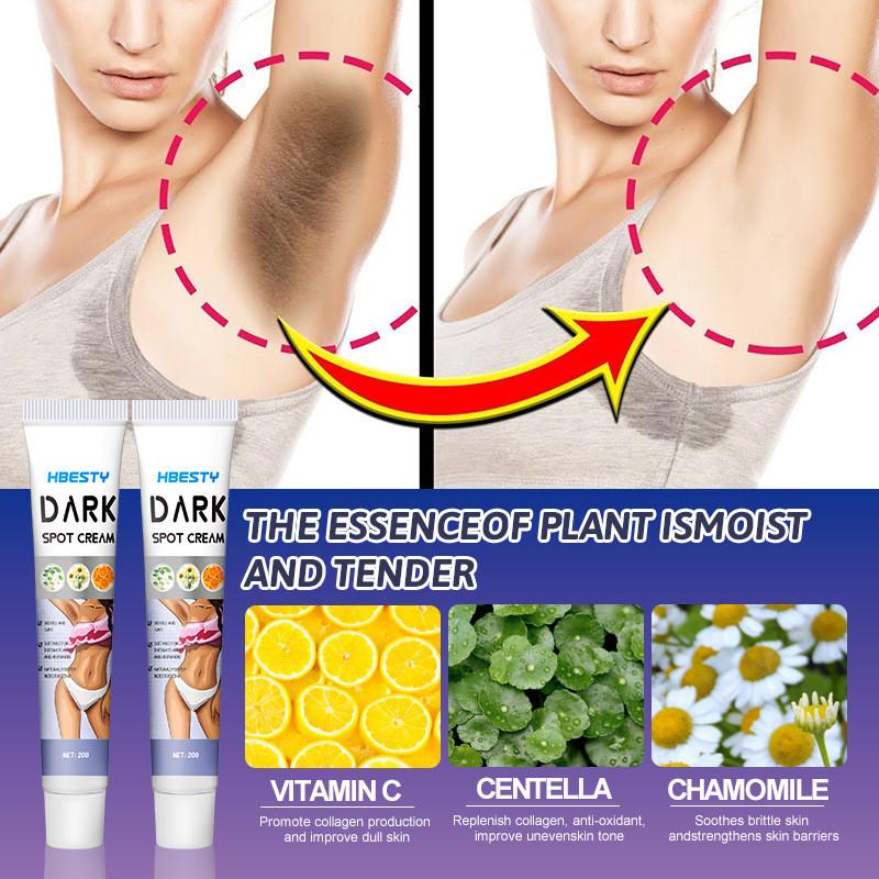 Hbesty Skin Brightening Cream For Underarm Thigh And Elbow Dark Spot Care